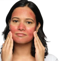 AHA 30% + BHA 2% Peeling Solution, 30 ml