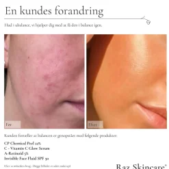 A-Retinoid 5% Serum, 30 ml
