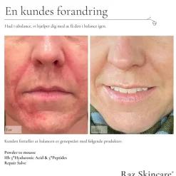 Hh 3*Hyaluronic Acid & 3*Peptides, 30 ml