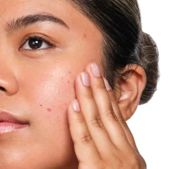 Salicylic Acid 2% Solution Serum, 30 ml