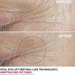 Total Eye Lift, 15 ml