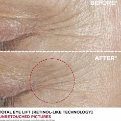 Total Eye Lift Refill, 15 ml